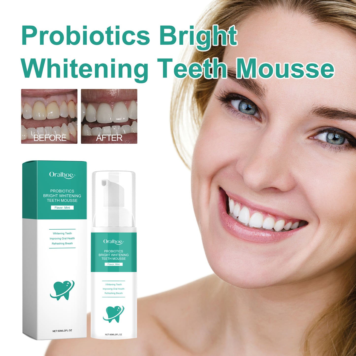 Mousse Dentaire Blanchissante Probiotiques - Innovation Sourire 60ml